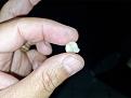 Click image for larger version

Name:	01 - DENTE QUEBRADO.jpg
Views:	1
Size:	34,6 KB
ID:	518174